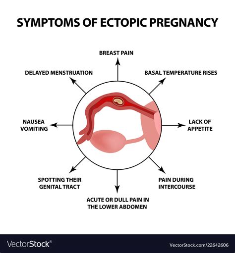 A Frightening Realization: Early Warning Signs of Ectopic Pregnancy